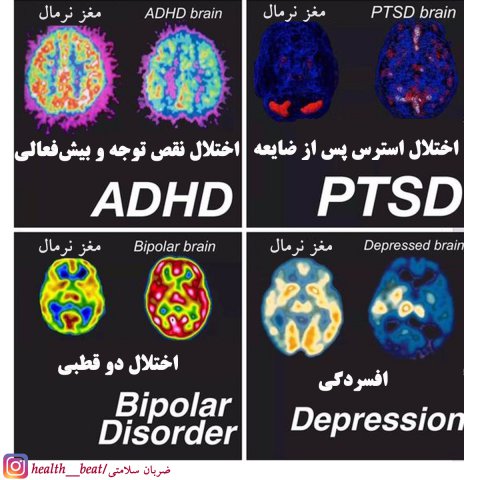 ضربان سلامتی - شهریور ماه 1399